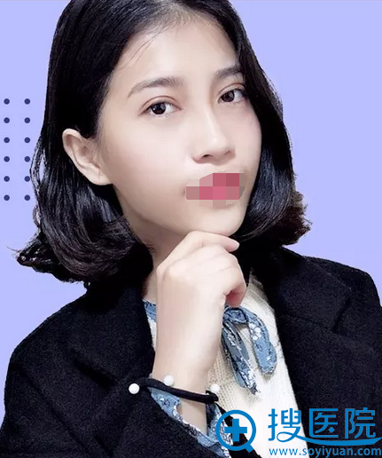 其实这是术后的我 其实这是术后的我