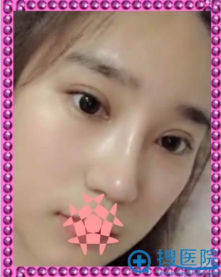 ǿΪ˫Ƥͼ¡һЧ