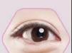 逆转眼部岁月 合肥华美针功夫去眼袋真是减龄的好方法
