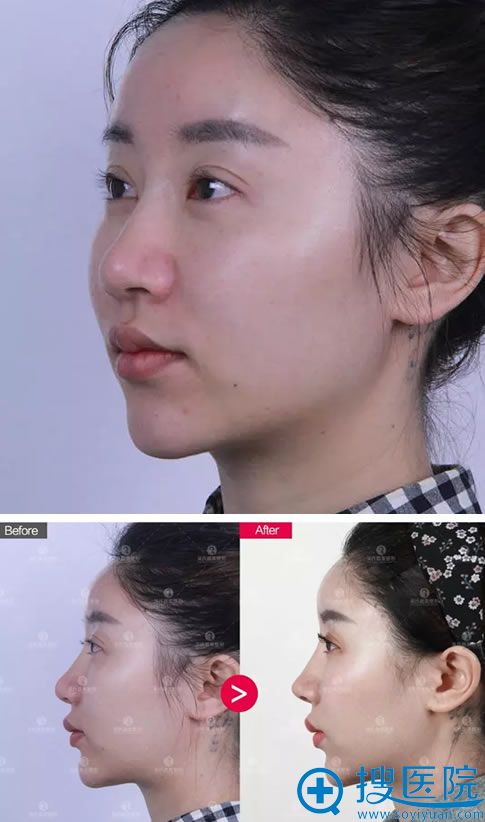 ϼ<!--<i data=20240710 data-id=16760></i>-->޸