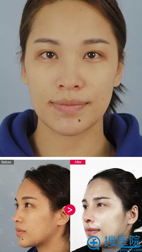 ϼμԺ<!--<i data=20240710 data-id=16760></i>-->ۺϰ