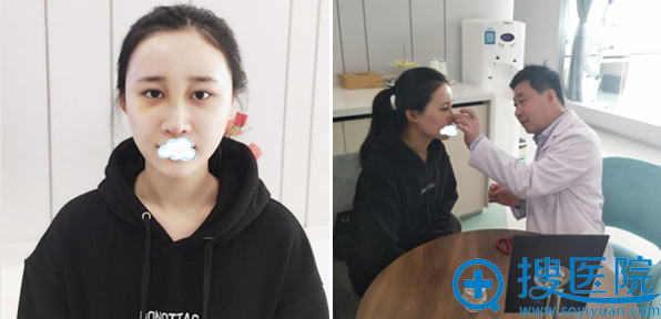 鼻修复手术后7天拆线复诊情况 鼻修复手术后7天拆线复诊情况