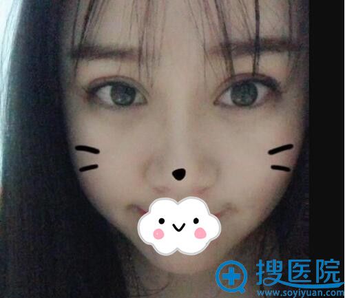 <!--<i data=20240710 data-id=9790></i>-->ҽԺ˫Ƥ100참