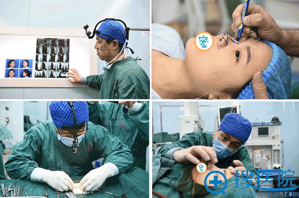 梁晓健肋软骨鼻综合手术全程