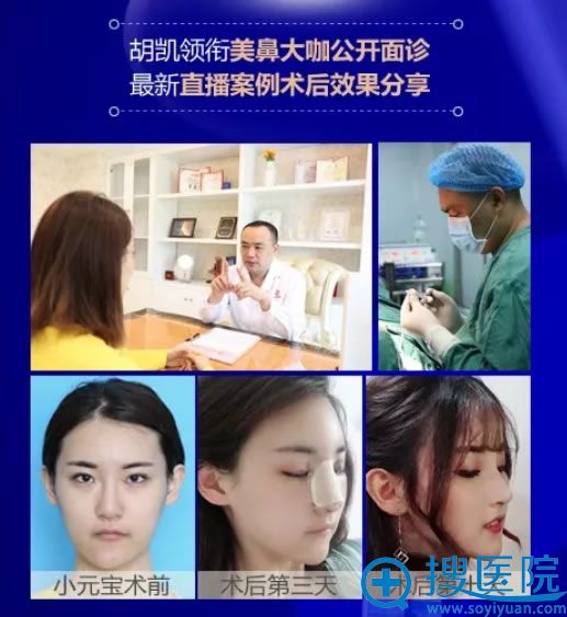华美胡凯携隆鼻真人案例现场坐诊