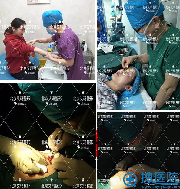 <!--<i data=20240710 data-id=11783></i>--><!--<i data=20240710 data-id=16469></i>-->院长双眼皮手术过程 <!--<i data=20240710 data-id=11783></i>--><!--<i data=20240710 data-id=16469></i>-->院长双眼皮手术过程