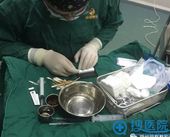 王新灿鼻综合手术过程之术前准备