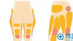 韩国巴诺巴奇腹部/大腿吸脂手术价格6折 夏季优惠活动开启