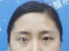 쿵ǹ лɽԺС¡Ǻ˫Ƥ