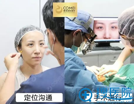 <!--<i data=20240710 data-id=15772></i>-->刘小剑设计双眼皮 <!--<i data=20240710 data-id=15772></i>-->刘小剑设计双眼皮