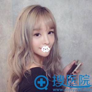 深圳贝漾美天双眼皮术后效果