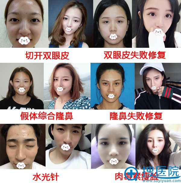 <!--<i data=20240710 data-id=8402></i>-->整形真人案例效果对比
