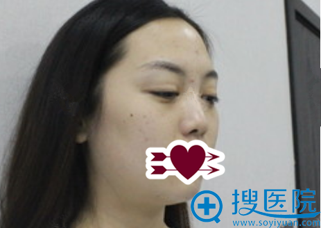 ûȥ<!--<i data=20240710 data-id=11467></i>-->ҽԺǱۺ¡ǰƬ