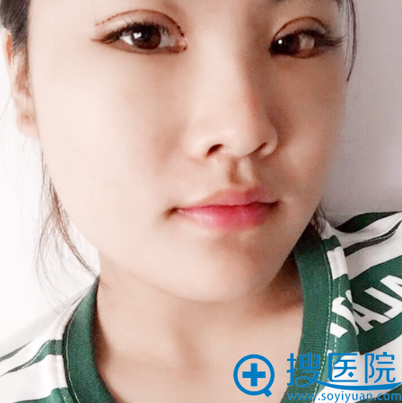 <!--<i data=20240710 data-id=13402></i>-->Ӣ˫Ƥ