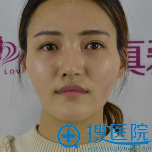 <!--<i data=20240710 data-id=12011></i>-->֬沿䰸