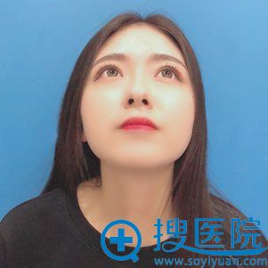南京速丽医疗美容瘦脸针案例
