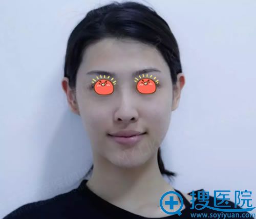 ڳɶ֬沿ǰ