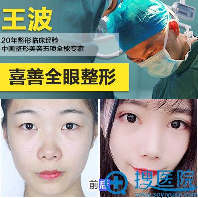 重庆铜雀台王波做的双眼皮案例对比图