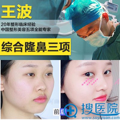 重庆铜雀台王波做的鼻综合隆鼻案例