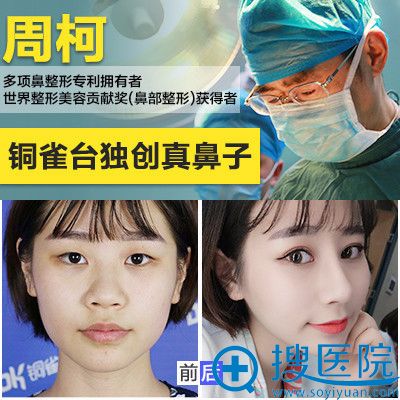 重庆铜雀台周柯做的鼻综合隆鼻案例