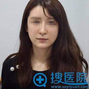 在<!--<i data=20240710 data-id=12083></i>-->取生长因子之前