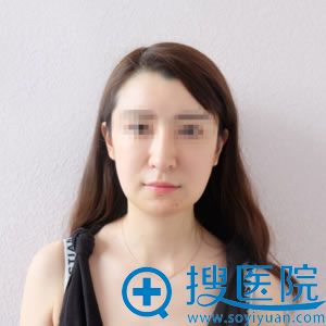 在<!--<i data=20240710 data-id=12083></i>-->生长因子取出修复7天后