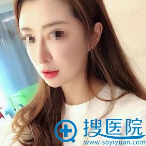 找北京尚益嘉容<!--<i data=20240710 data-id=17407></i>-->取出生长因子30天后