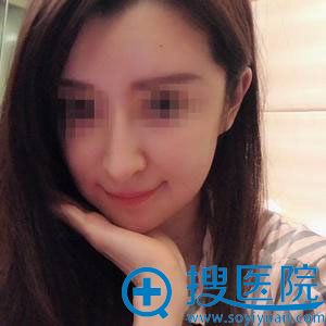 做生长因子取出修复2个月恢复照