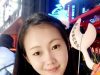 去临沂瑞丽整形医院找郎继春做双眼皮前我还考虑过临沂伊维美