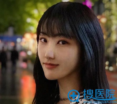 找北京华韩柳民熙做隆鼻前