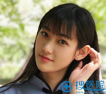 选择北京华韩柳民熙做隆鼻1个月后