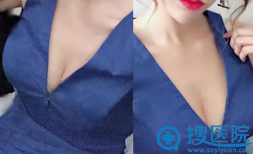 ѡ֮¡20