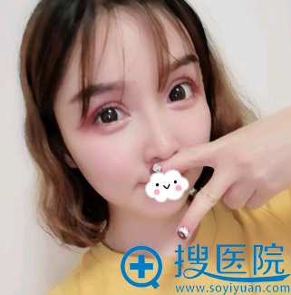 成都<!--<i data=20240710 data-id=16572></i>-->眼整形与修复医学研究院眼部修复效果图