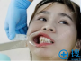 分享我找杭州连天美王婵做牙齿矫正的亲身经历和收费价格表