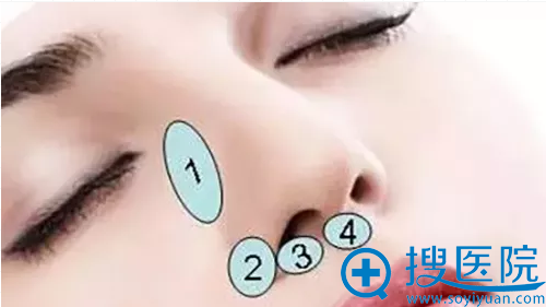 鼻基底是位置示意图
