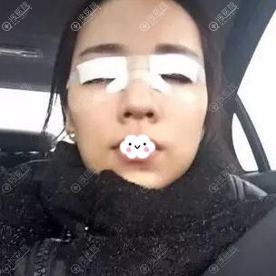 ˫ƤļҺã<!--<i data=20240710 data-id=11547></i>-->п˫ƤЧ