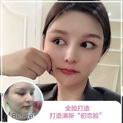<!--<i data=20240710 data-id=12088></i>-->ҽԺҽ֬沿䰸