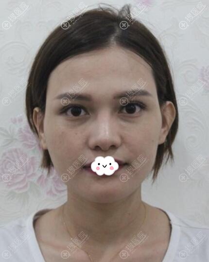 ݻҽﲿע尸