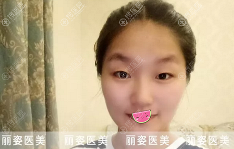 ǰἡƤɳ