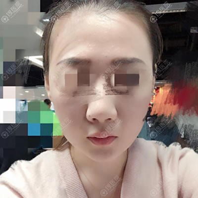 <!--<i data=20240710 data-id=12728></i>-->沿ߵ2º