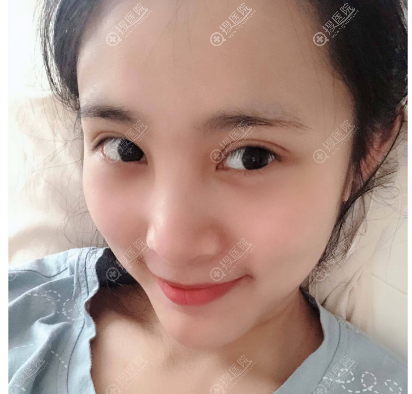 <!--<i data=20240710 data-id=10622></i>-->医美朱小平做双眼皮怎么样