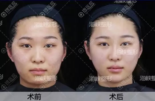 ϺϿ䰸