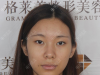 我对比过福州格莱美和海峡的价格后,找格莱美庄爱先做了双眼皮