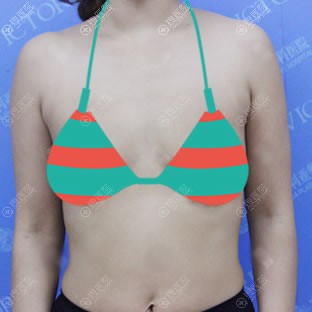 ά¡ǰ