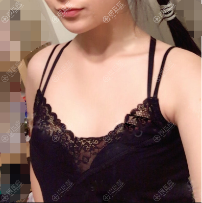 ҺǰƬ
