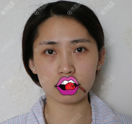 ҽԺ֬ǰ