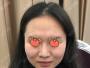 我的小V脸是通过在北京和美嘉做面部吸脂瘦脸得来的,花了好几万