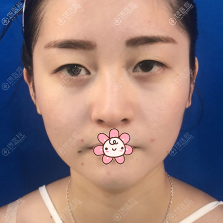 ȥϺ˫ƤǰƬ
