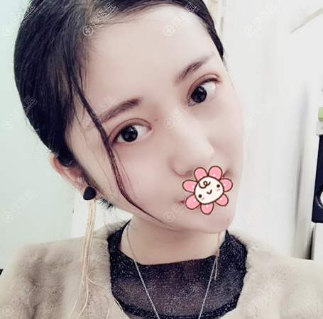 Ϻ˫Ƥ