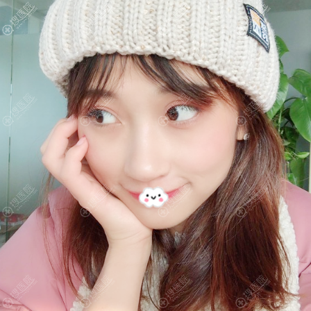 ˫Ƥ15ָЧͼ